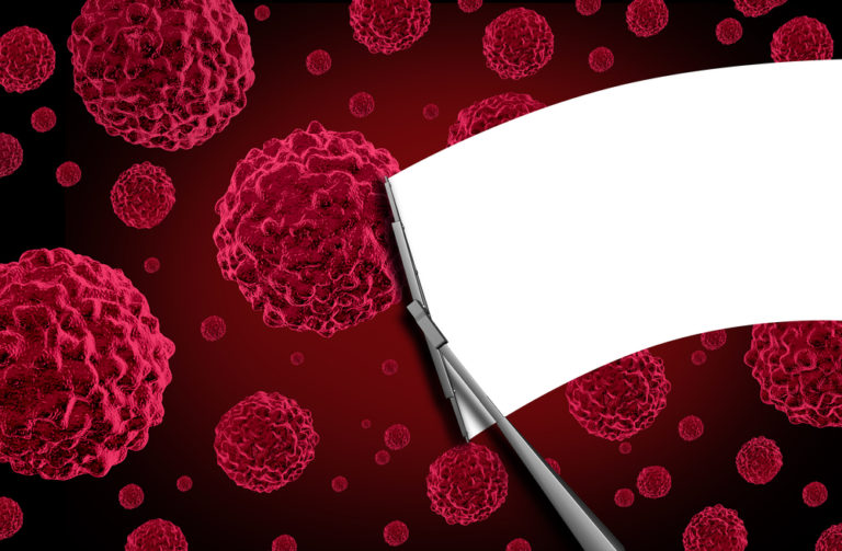 How Doctors Determine How to Treat Cancer