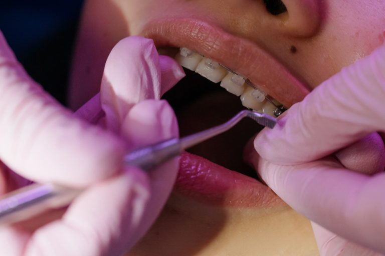 7 Ways Untreated Dental Problems Affect Your Overall Health