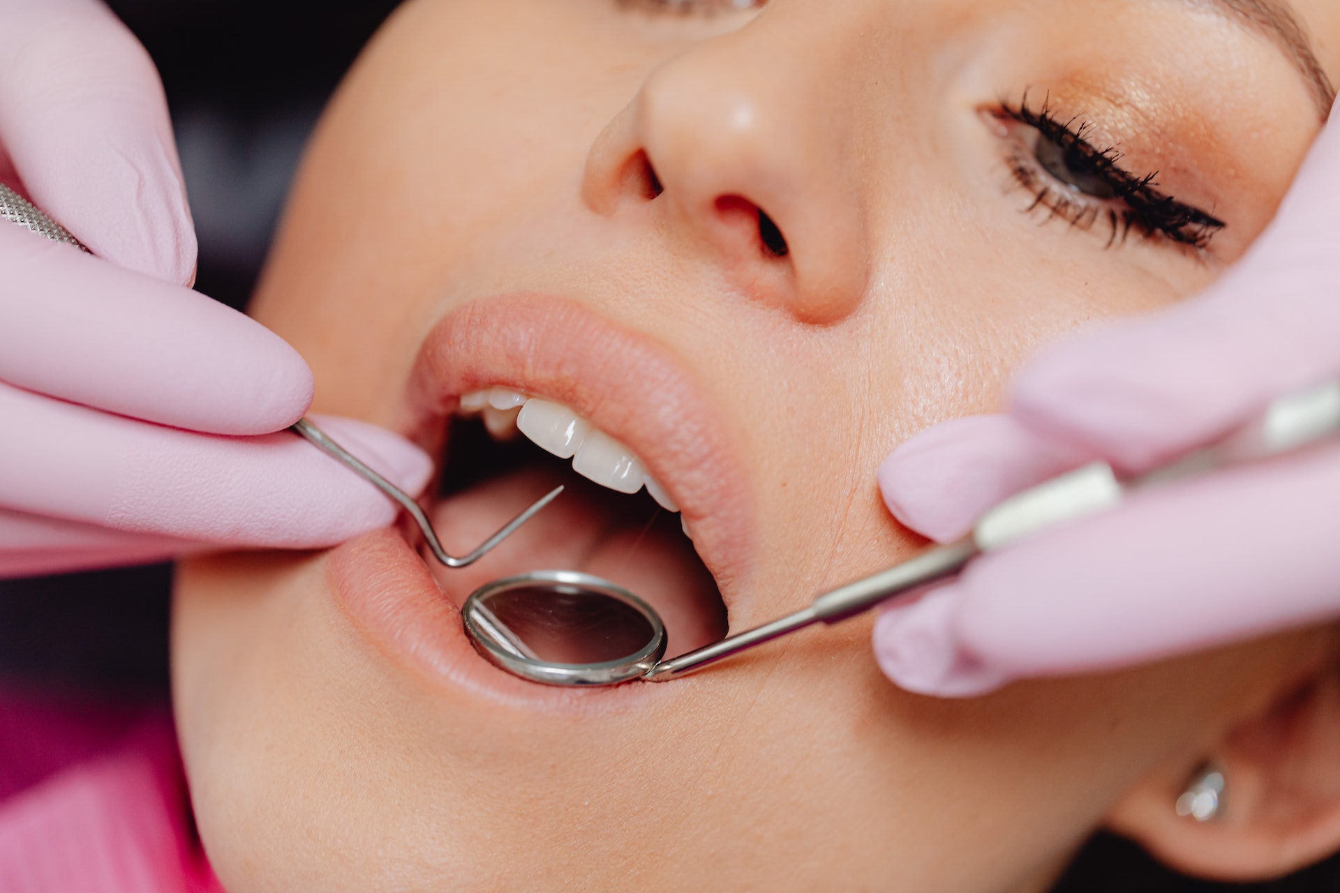 5 Common Reasons People Need To See a Prosthodontist