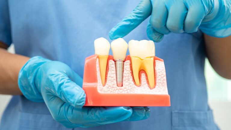 How Often Should You Get a Dental Cleaning in Utah?