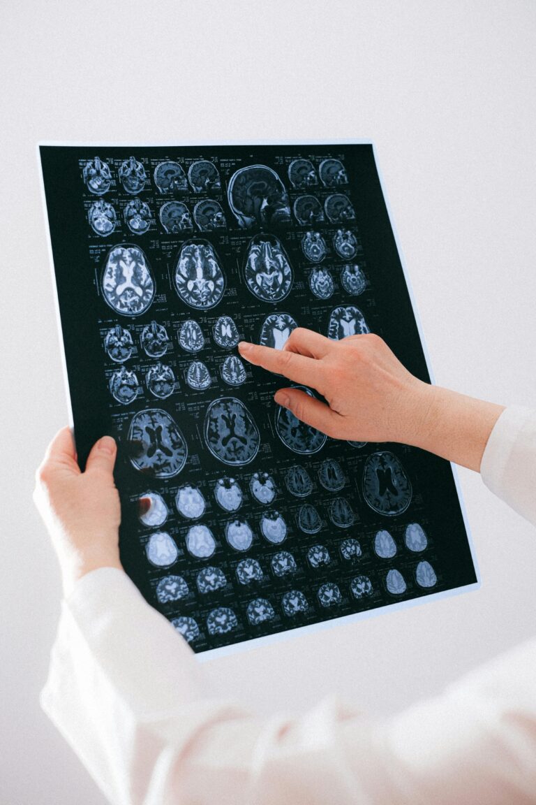 The “Hidden” TBI Crisis